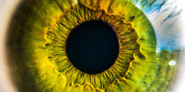Iridology, iris image.