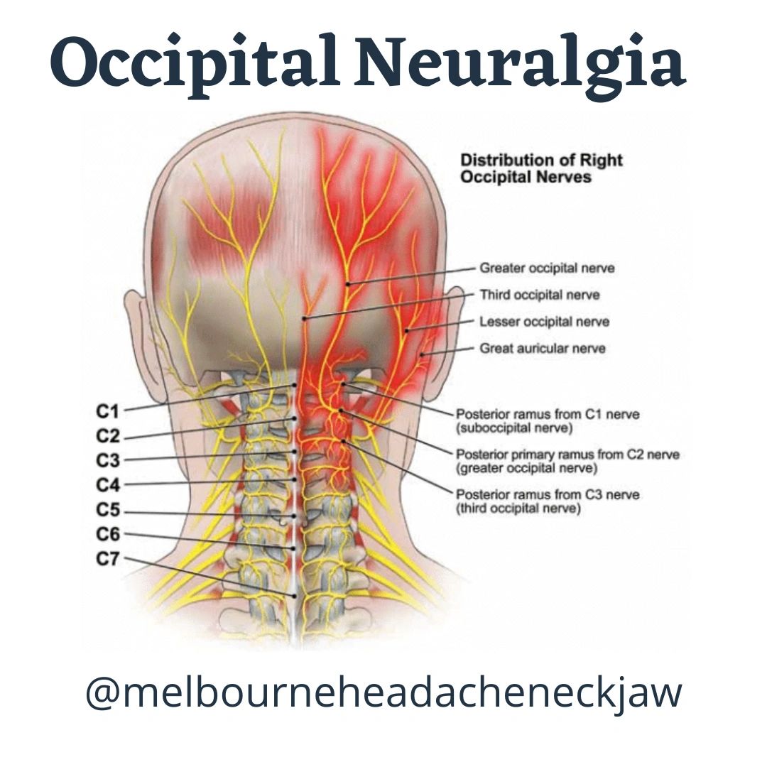posterior auricular nerve block