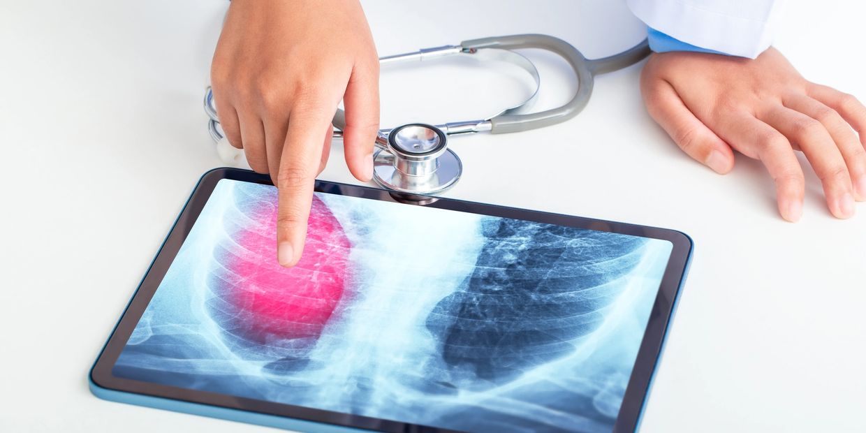 doctor's hand pointing at a lung from an x-ray on a tablet showing a concern in red  