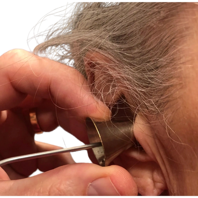 Ear Wax Cleaning  Removal & Microsuction — INMC