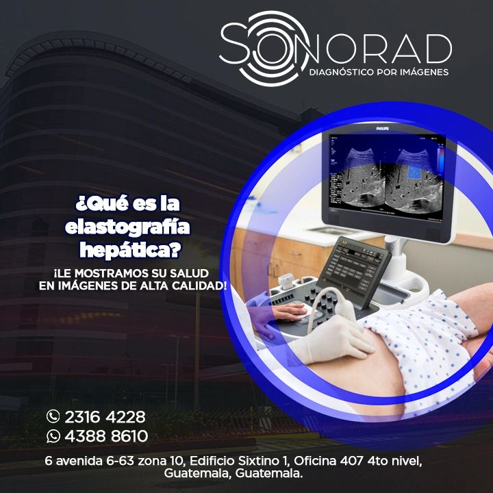 Fibroscan vs Elastografía Hepática Shear Wave, diferencias?