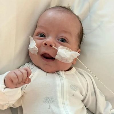 Premature Baby awake, happy with Feeding Tube in his nose and tape on his face.