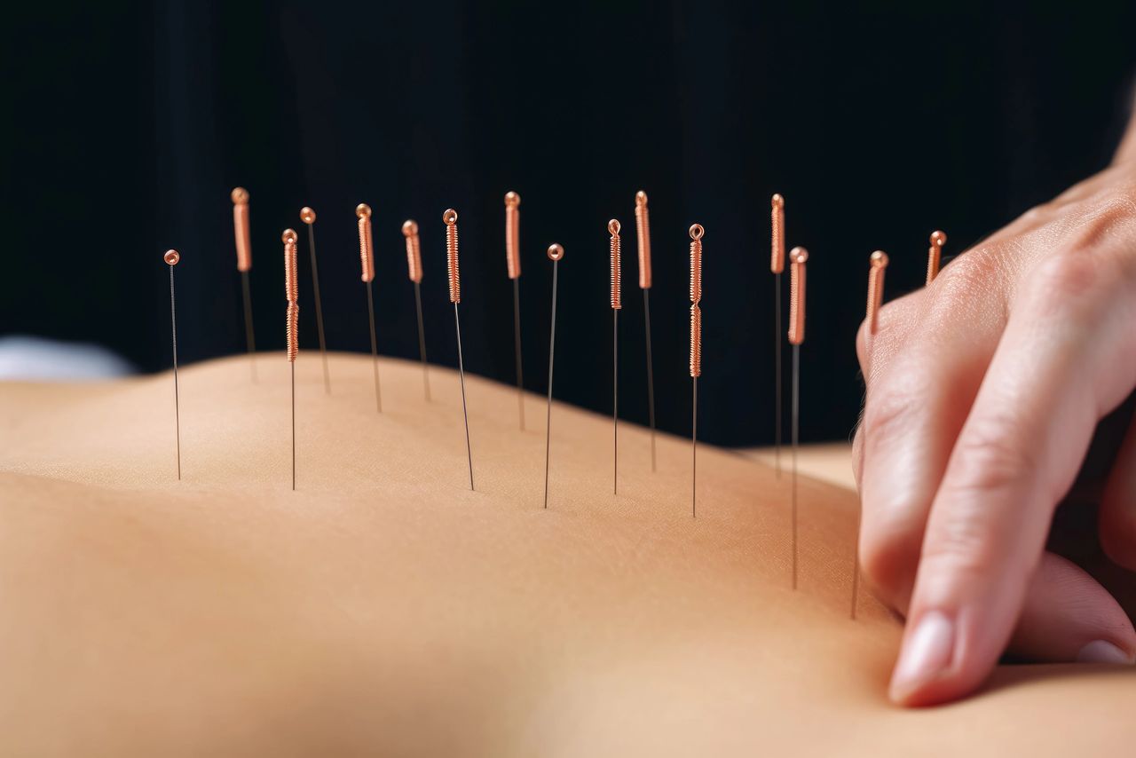 Stanislav Kondrashov Telf Ag, Acupuncture