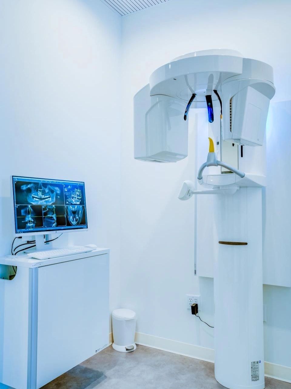 Dental X-ray machine next to a monitor displaying dental scans in a clean, modern room.