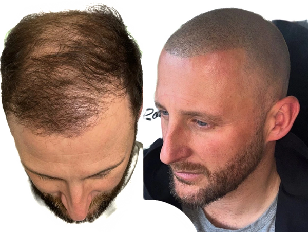 Thinning no problem. New look sorted