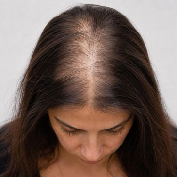 Woman with thinning hair looking down.
