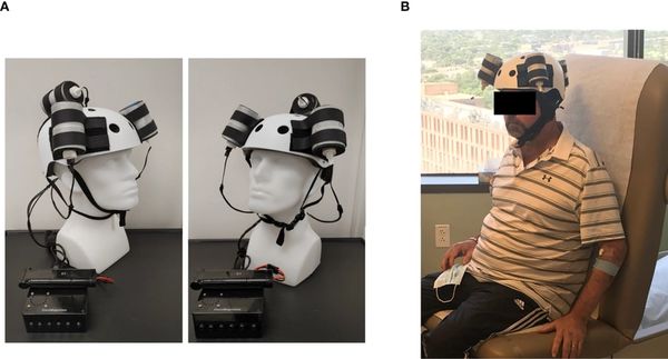 A wearable brain stimulation helmet and a patient wearing it in a clinical setting.