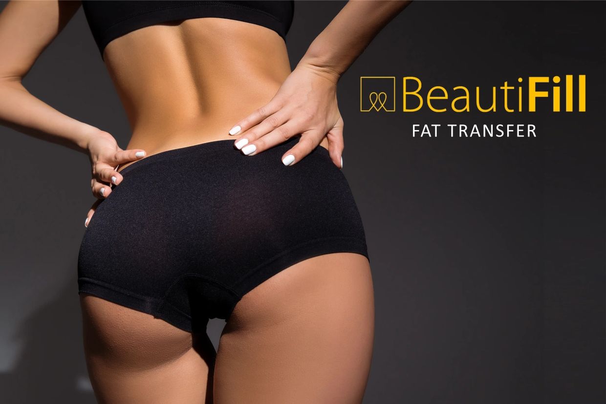 Close-up of a fit woman highlighting BeautiFill fat transfer.