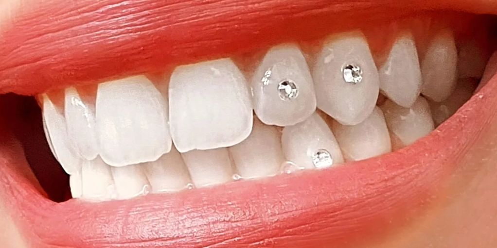 Bright smile with rhinestone-studded teeth and red lips.