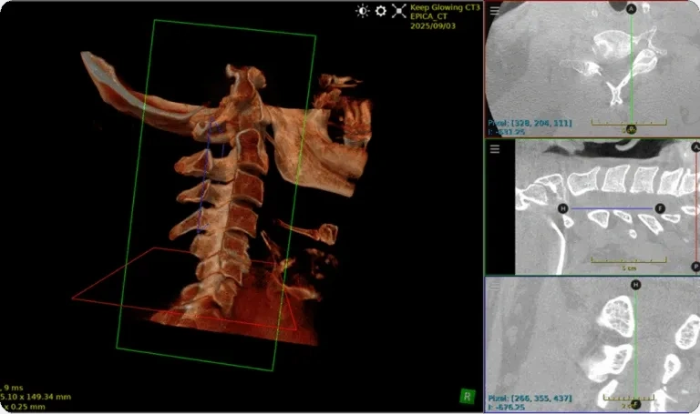 Low-Dose, High-Definition Technology