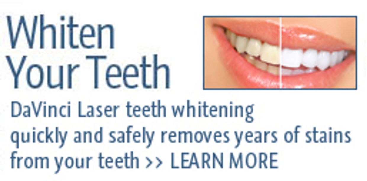 Davinci Teeth Whitening
