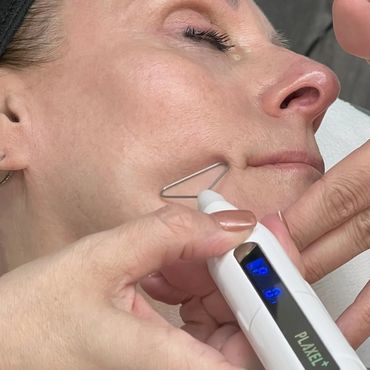 Woman getting Plasma Channeling