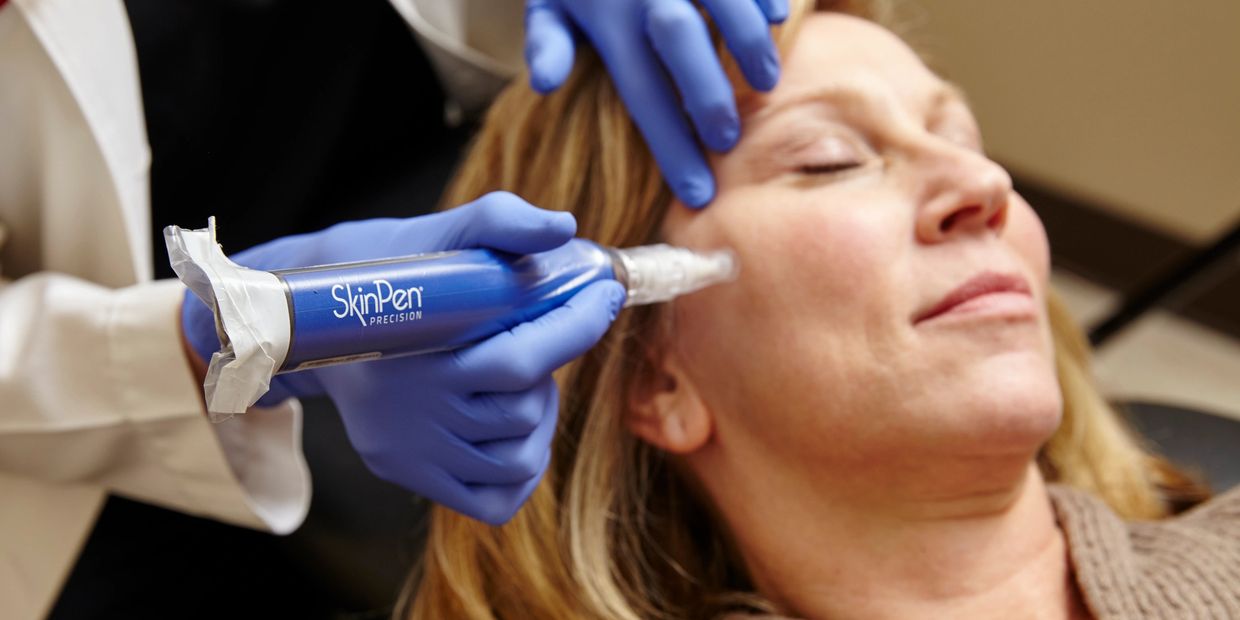 A woman getting SkinPen Microneedling treatment.