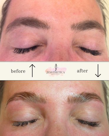 Brow lamination 
