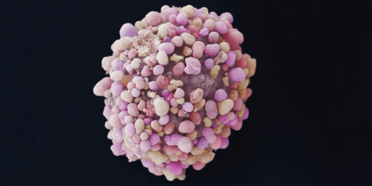 Breast Cancer Research 