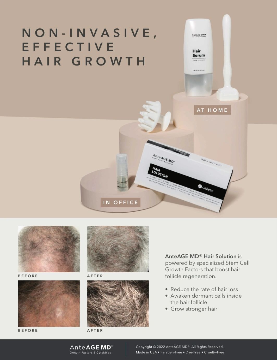 Sudbury, Non Surgical, Hair Loss Restoration - Essentia Advanced