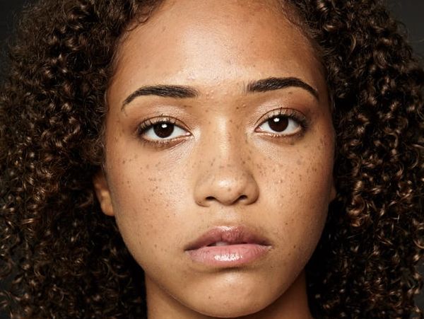 Model with natural curly hair showcasing clear glowing skin treatment.
