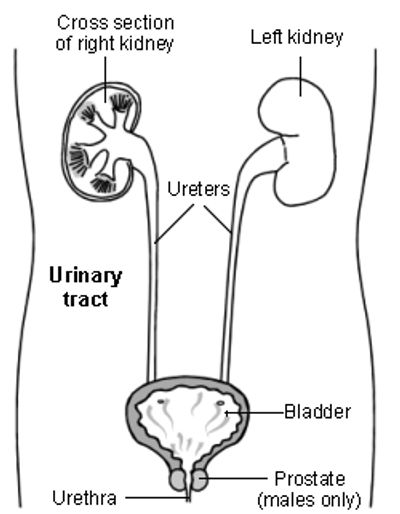 Bladder Cancer