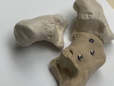 Printed foot bone FibreTuff