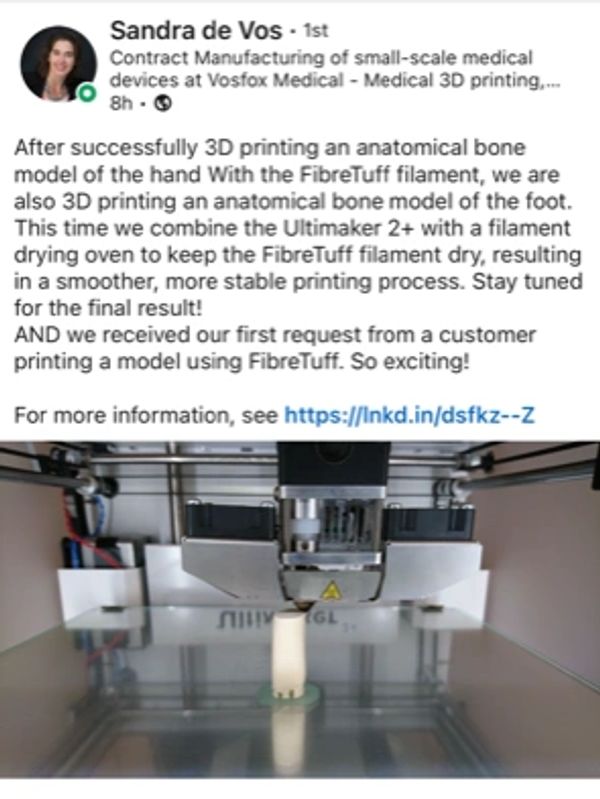 3D Printing Hands by VosFox Medical