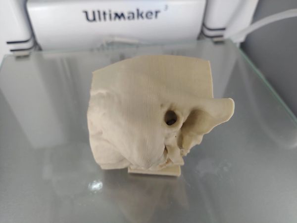 3D printed temporal bone made with FibreTuff PAPC