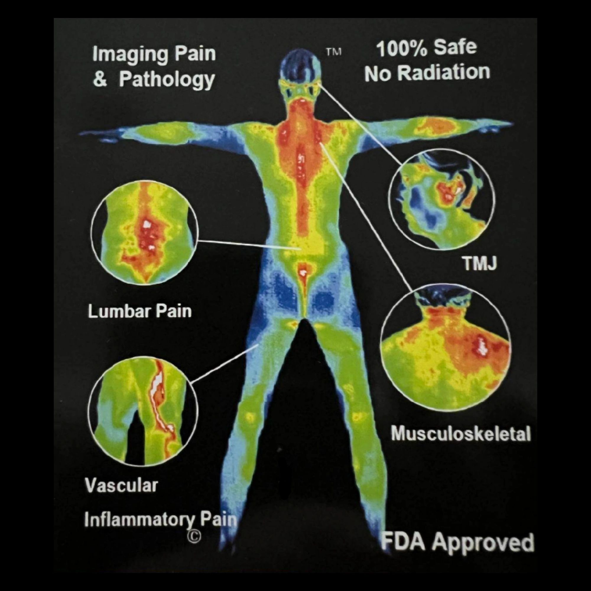 Bras and your Lymphatic System - Thermography For Health NY