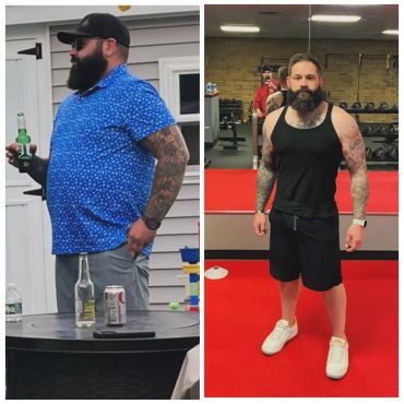 Side-by-side photo showing weight loss transformation of a bearded man.