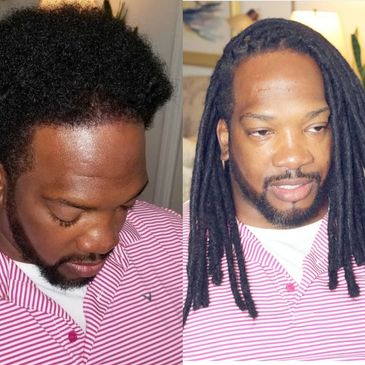 Collage of a man before and after Dreadlocks hair extensions