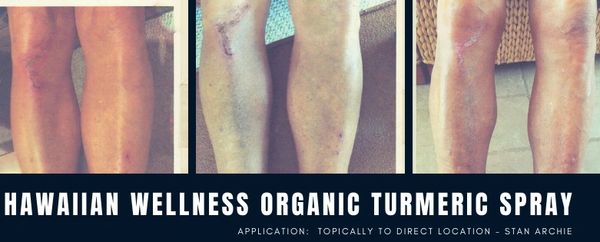 WELLNESS PRODUCT: ORGANIC TURMERIC SPRAY 
APPLICATION: TOPICALLY TO DIRECT LOCATION