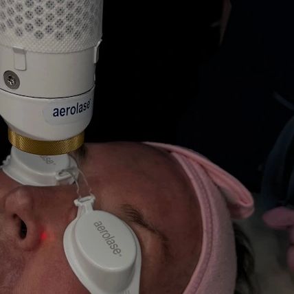 Facial laser treatment using Aerolase device.