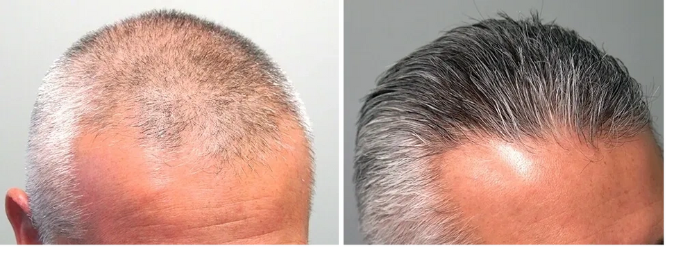 Hairagra Inventory System