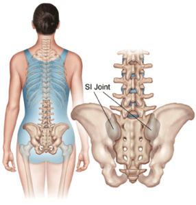 sacroiliac joint surface anatomy