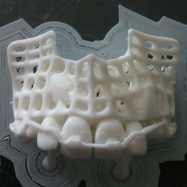 Impresión 3D de Biomodelos para planificación quirúrgica