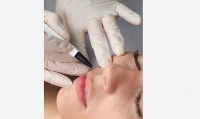 Permanent Hair Removal