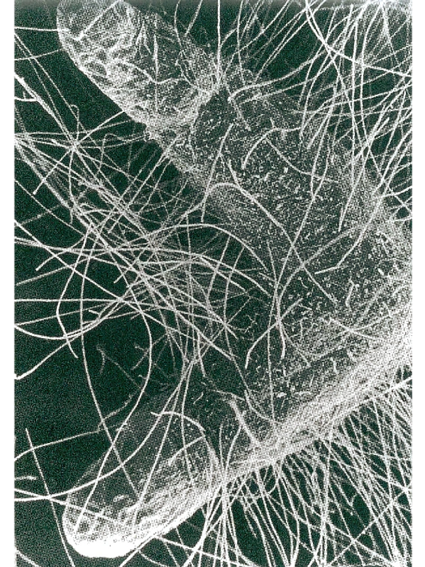 Micorrhizae