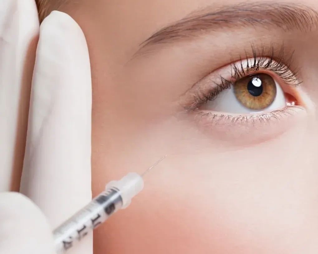 Botox injections to smooth wrinkles and refresh the face