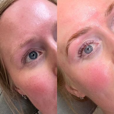 Lash lift