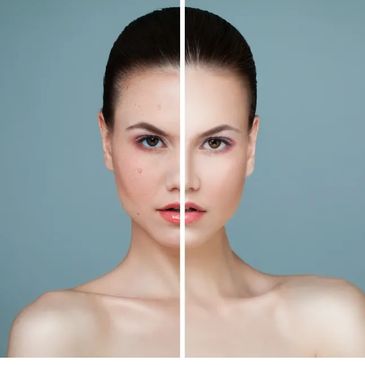 BB Glow before and after picture