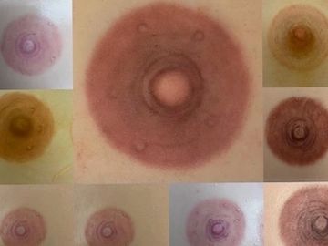 Areola Restoration Micropigmentation 2022