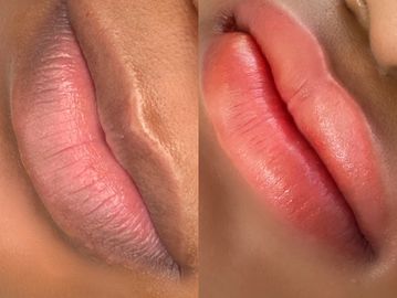High melanin dark lips lightened