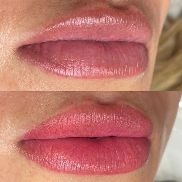 Close-up of lips before and after color fading or removal treatment.