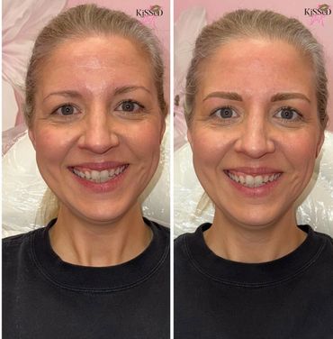 Before and after eyebrow enhancement on a smiling woman.