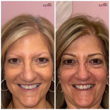 Before and after eyebrow enhancement on a smiling woman.
