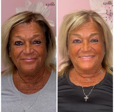 Side-by-side photos of a woman before and after a beauty treatment, showing a refreshed appearance.