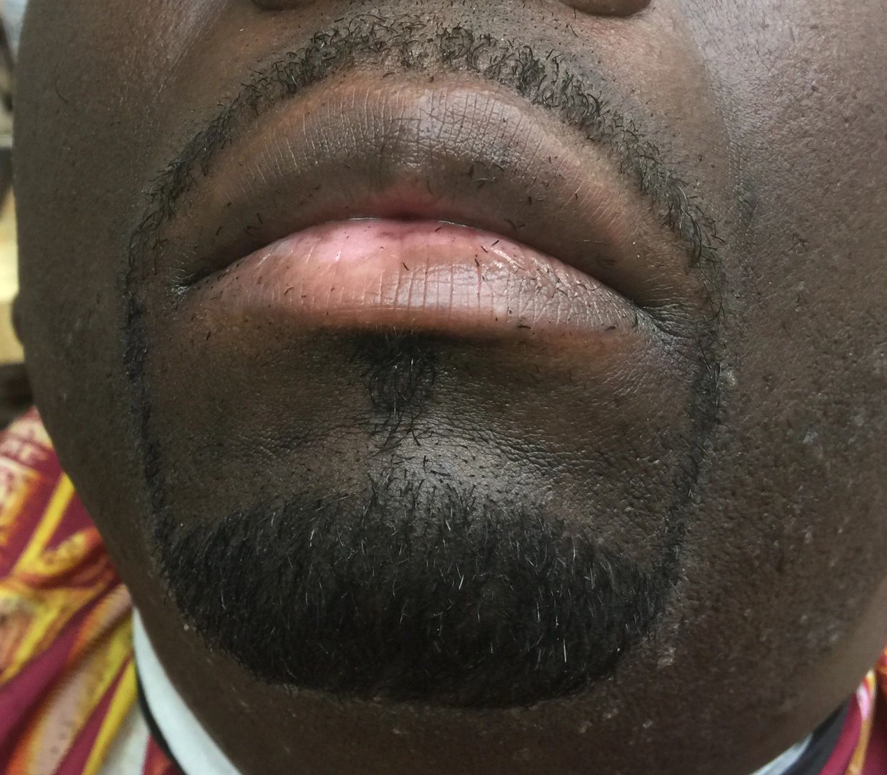 Close-up of a man's lips and beard area.