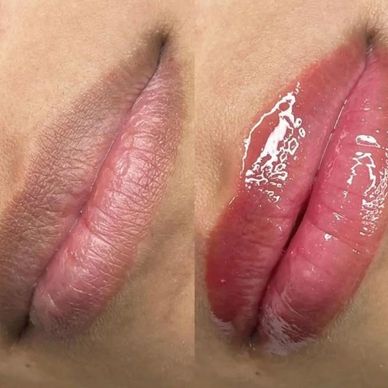 Close-up of lips before and after applying glossy lip product.
