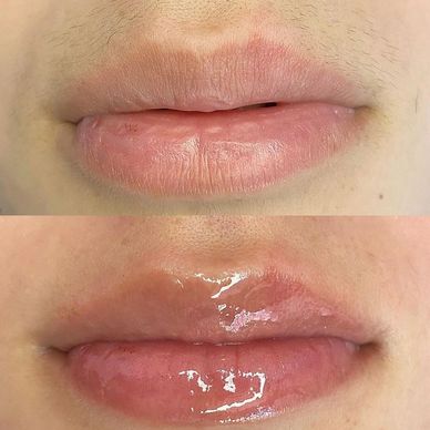 Before and after lip hydration treatment showing natural lips and glossy, moisturized lips.