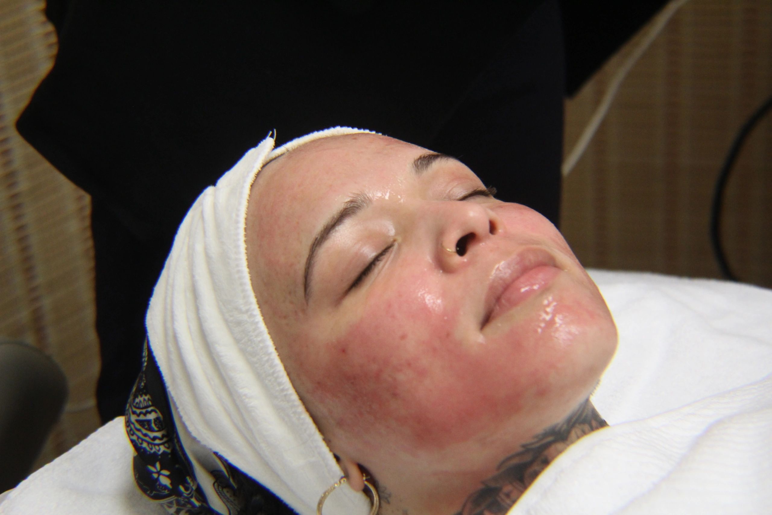 A woman with a bandage on her head is laying down with her eyes closed.