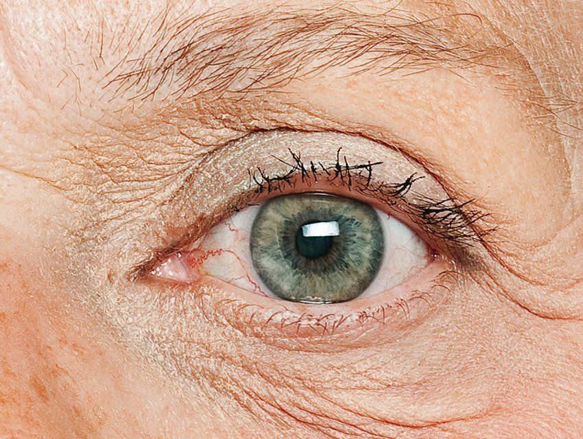 нарушение зрения у пожилых. офтальмолог катаракта. лечение катаракты без операции. сенильная катаракта патогенез. глаза пожилого мужчины.