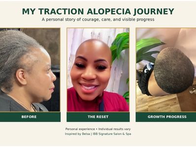 Three images showing a woman's traction alopecia journey progress.